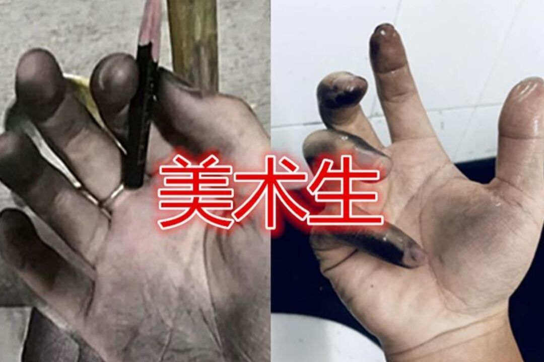 看手能区分学生的差别? 体育生粗糙美术生脏, 看到医学生让人心疼