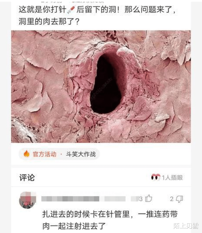 “打针后留下的洞, 那么洞里的肉究竟哪去了呢? ”真疑惑