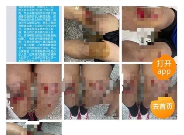 高校学生校内骑车避让小孩摔倒遭家长辱骂, 学校: 被撞小孩系教职工子女, 已和解