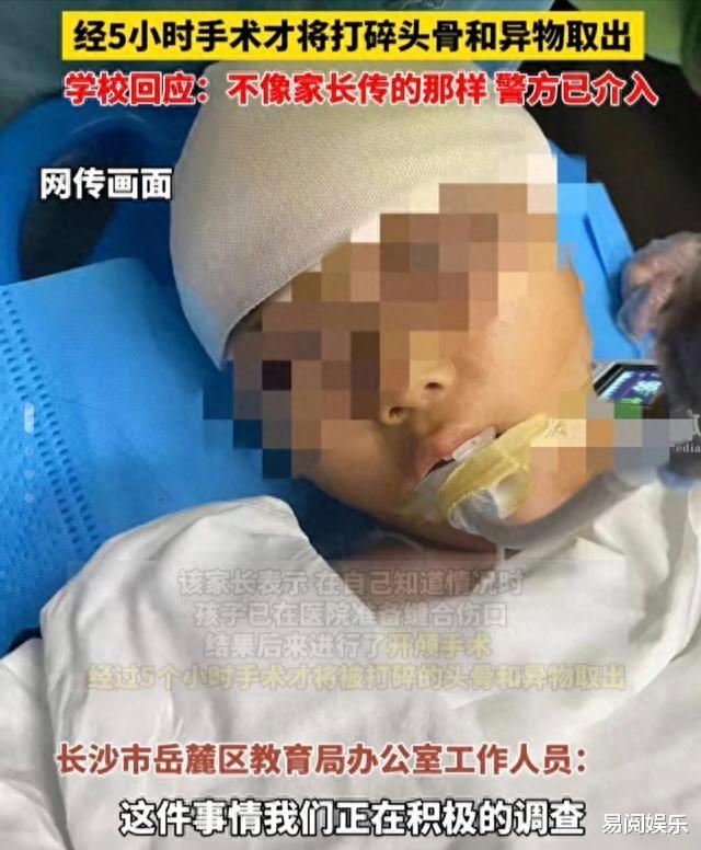 太狠毒! 打出脑浆, 学生犯了什么罪, 老师要用三角尺下死手