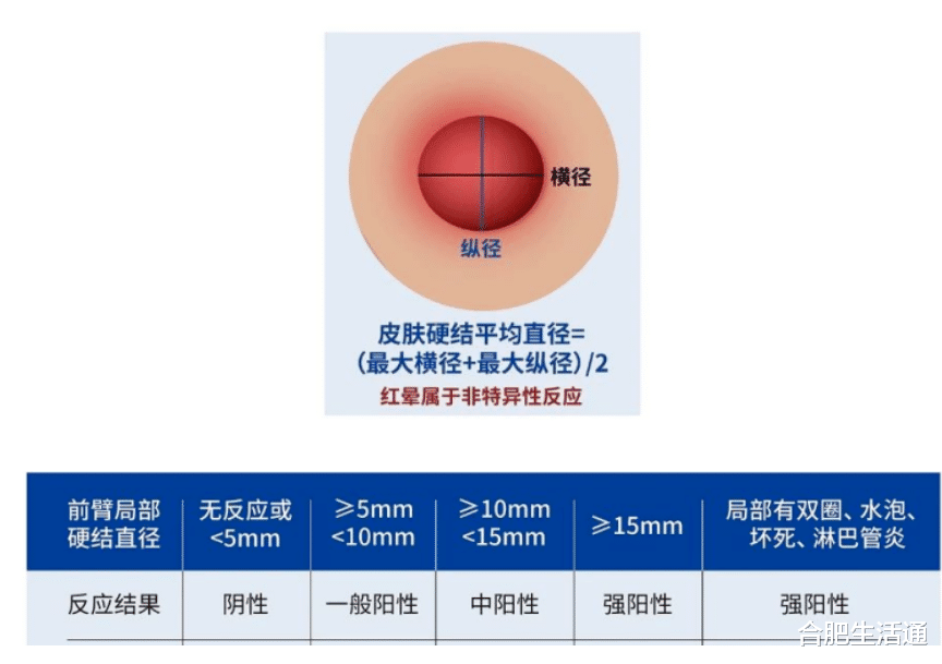 关系新生! 合肥新生入学结核病筛查开始!