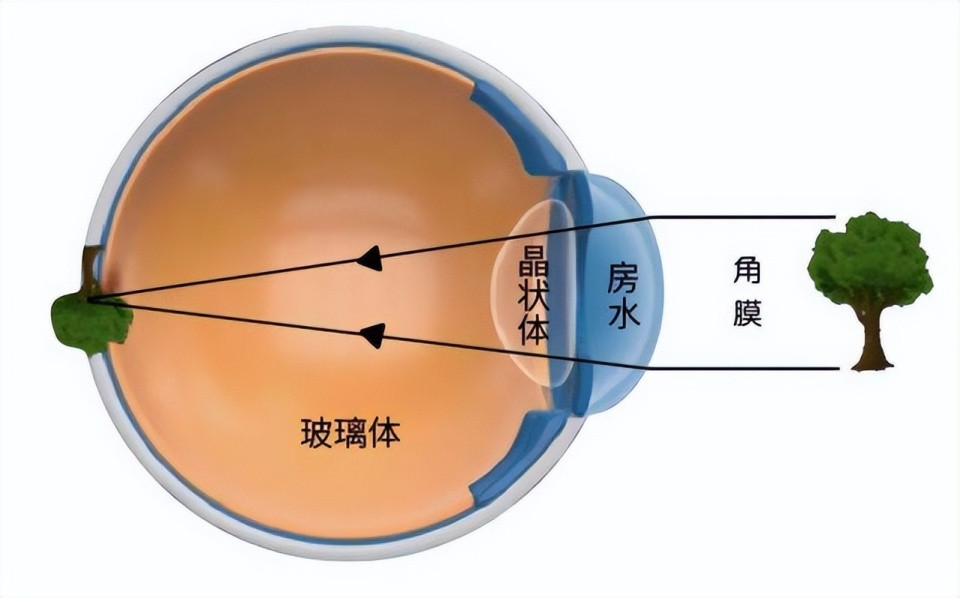 大学教授让他助力戴上倒立眼镜, 10天后助理分不清自己的倒立世界